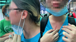 Bộ GDDT vào cuộc vụ phụ huynh trường quốc tế tố con bị bạo hành 