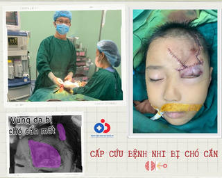 Cấp cứu thành công cháu bé bị chó cắn rách mặt