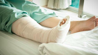 Phòng tránh biến chứng sau bó bột