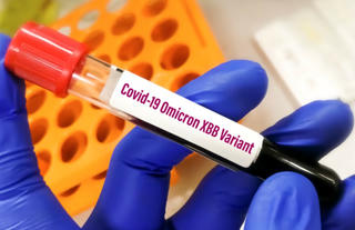 Biến thể mới XBB lây lan nhanh, giới chuyên gia nói gì?