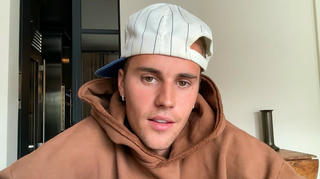 Justin Bieber bị liệt nửa mặt do nhiễm virus hiếm