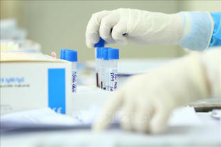 Hết nguồn sinh phẩm, Viện Pasteur Nha Trang tạm hoãn nhận mẫu xét nghiệm Covid-19