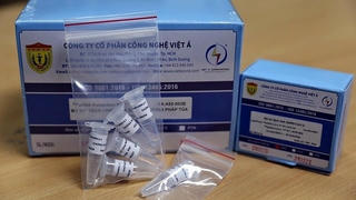 Kẽ hở từ đâu?