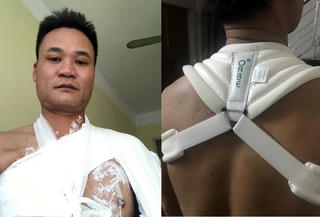 Hải Dương: Vô cớ đánh người rồi trốn tránh trách nhiệm