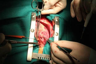 25 bệnh nhân nghèo ở ĐBSCL được mổ tim
