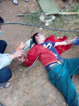 Kinh hoàng người đàn ông bị chiếc xà beng đâm xuyên qua người