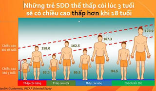 Người Việt lùn do ăn mặn,  thừa đạm, thiếu canxi