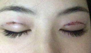 Để đẹp đâu cần trả giá