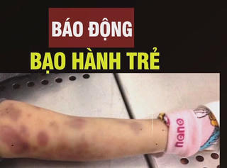 [VIDEO] Hãy gọi tổng đài 111 để tố giác hành vi bạo hành trẻ em
