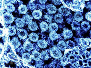 Phát hiện mới về khả năng lây lan của virus SARS-CoV-2