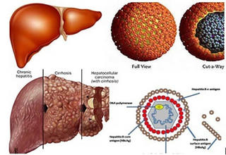Cách phòng chống viêm gan virus B và C