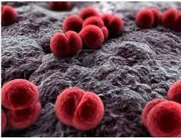 Ca nhiễm não mô cầu đầu tiên ở Hà Nội đã qua cơn nguy kịch