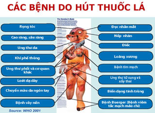 Cần thiết phải tăng thuế thuốc lá