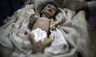 Khủng hoảng lương thực Syria qua hình ảnh em bé chết đói
