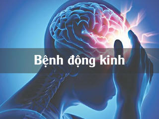 Hơn 60% bệnh nhân bị động kinh có thể được chữa khỏi nếu tuân thủ điều trị