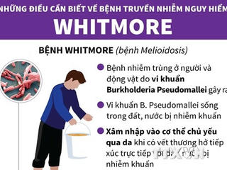 [Infographics] Những điều cần biết về căn bệnh nguy hiểm Whitmore