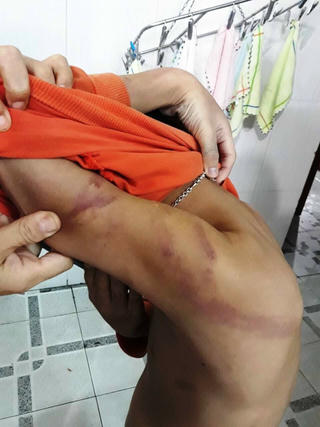 Đề xuất xử phạt hành chính người cha bạo hành con ruột bằng dây điện