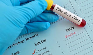 Ghi nhận 119 trường hợp mắc virus Zika tại TP HCM