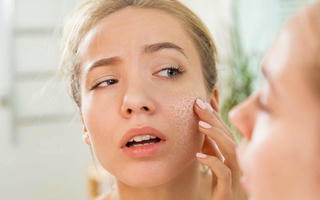 Mẹo trị dứt điểm tình trạng khô da, nứt nẻ trong mùa lạnh