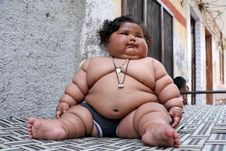 Bé gái 8 tháng tuổi nặng 19kg