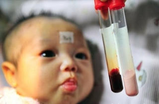 Tan máu bẩm sinh: Cha mẹ hiểu biết, con sẽ không gánh bệnh