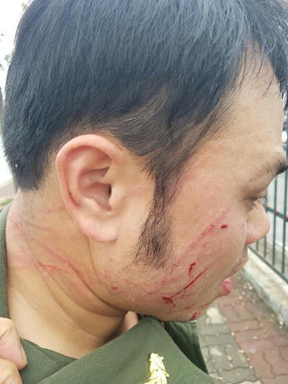 Nhân viên An ninh hàng không Nội Bài bị hành hung