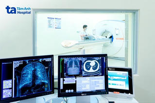 Ung thư phổi do thói quen hút thuốc lá lâu năm