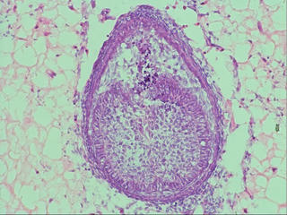Cuộc đua “nuôi” răng người trong phòng thí nghiệm