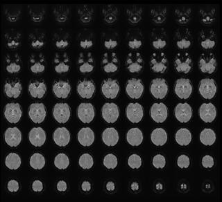Chuyển hình ảnh trong não thành văn bản
