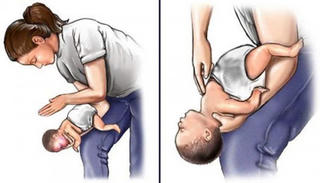 Hóc dị vật đường thở, nguy cơ tử vong cao 